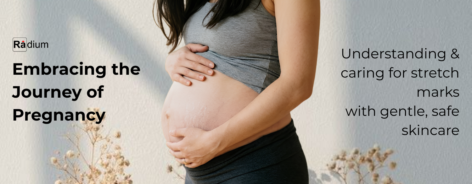 Embracing the Journey: Understanding & Caring for Pregnancy Stretch Marks