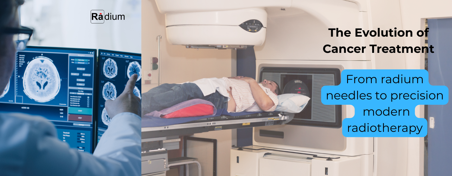 Radium Needles To Radiotherapy