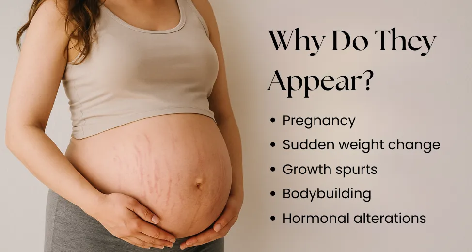 why do they appear